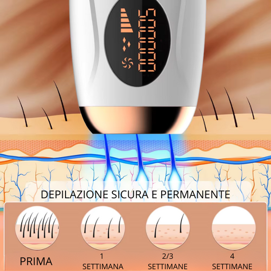 Epilazione Professionale a Casa: Dì Addio ai Peli Superflui!